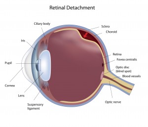 retinaldetachment copy