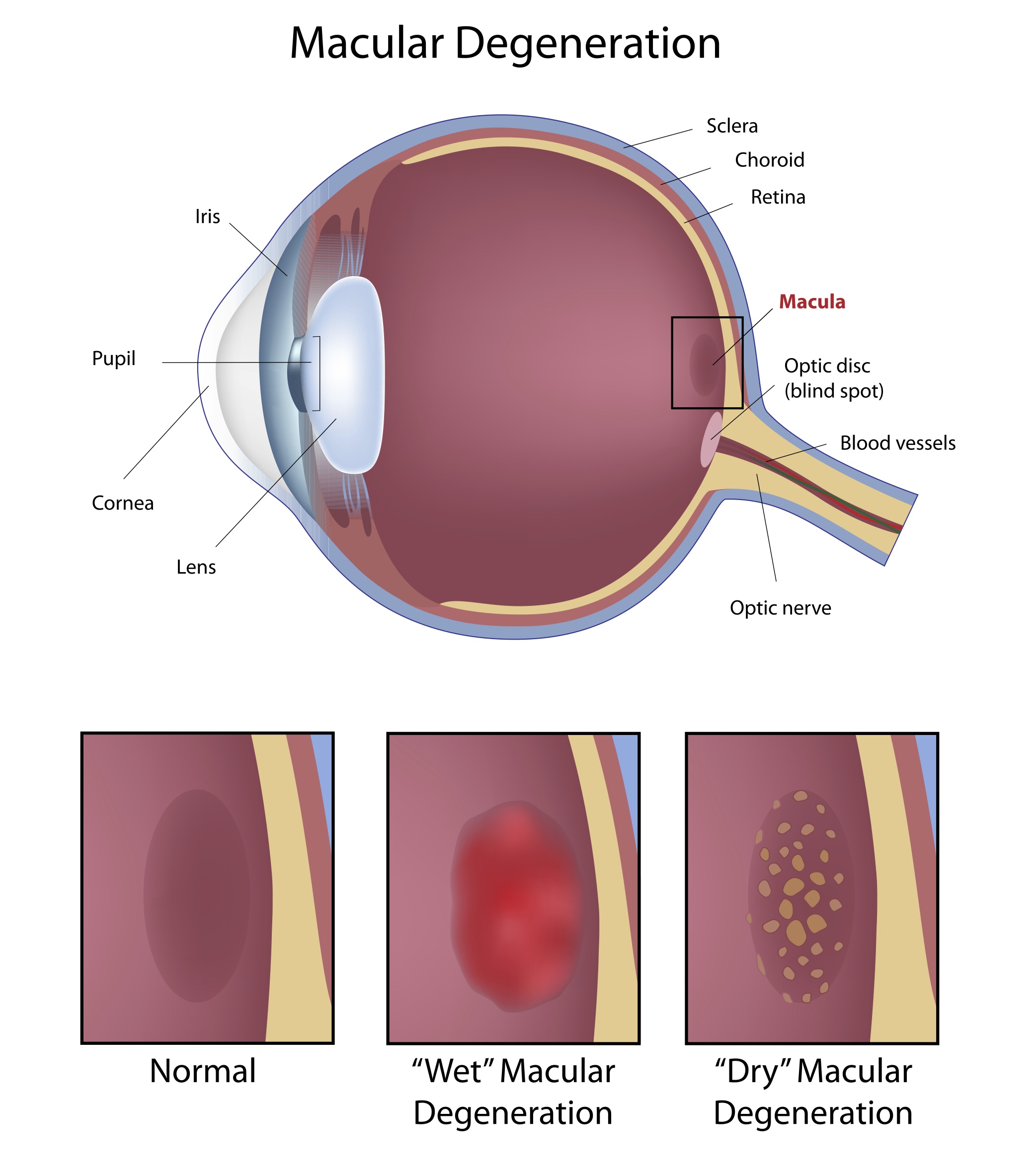 retina eye
